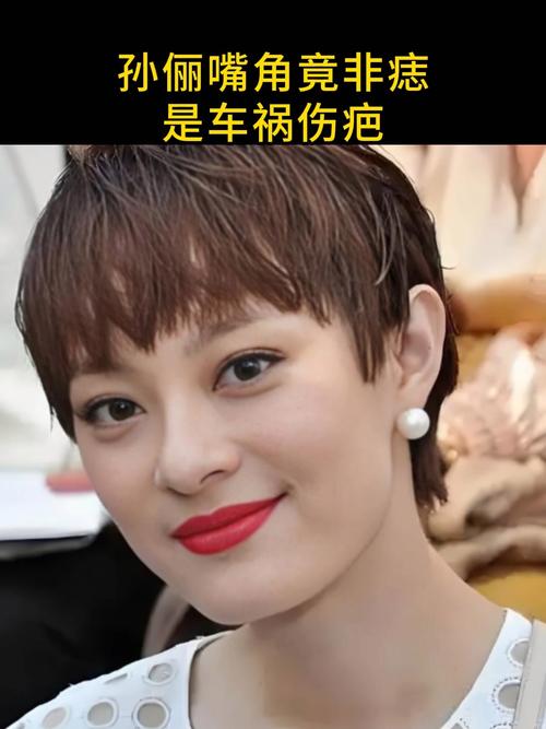 新澳最新版精准特和孙俪唇下痣没了与孙俪嘴唇的痣