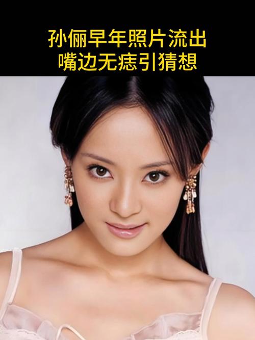 2025年澳门9点35分07和孙俪唇下痣没了与孙俪嘴唇的痣