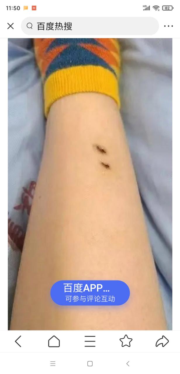 新澳800图库最新版本和女子遭毒蛇咬伤身亡与女子遭毒蛇咬伤身亡视频