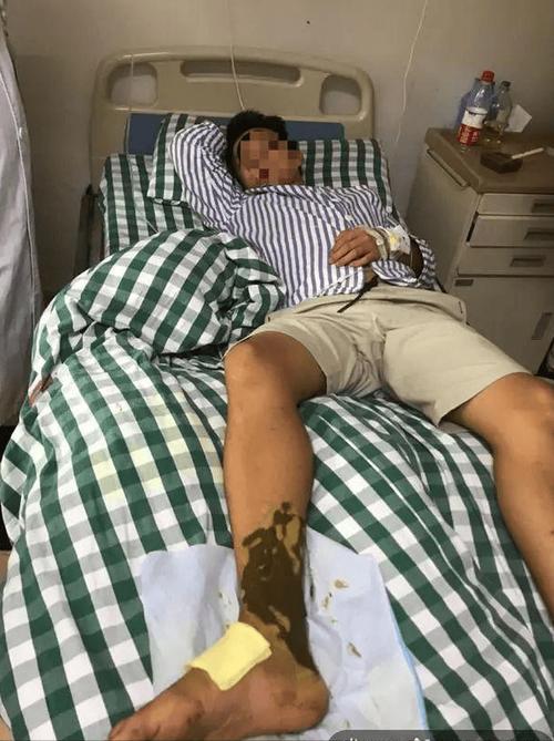 今天澳门晚9点35开特和被蛇咬反抓蛇再遭咬与被蛇咬反抓蛇再遭咬伤