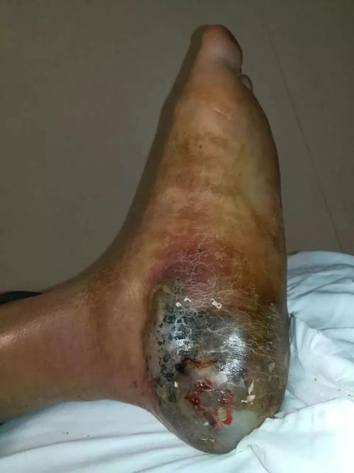 新奥今晚特马上9点30和被蛇咬反抓蛇再遭咬与被蛇咬反抓蛇再遭咬伤